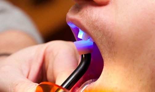 Dental patient having a light shined on their tooth