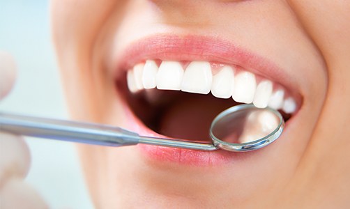 Close up of mouth receiving dental exam