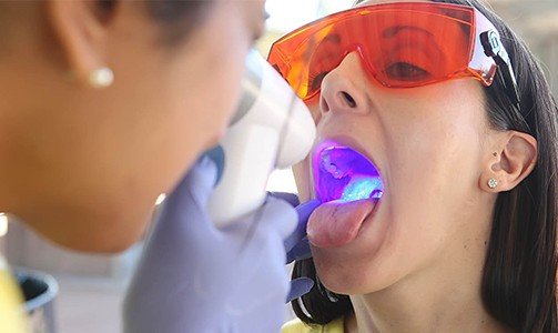 Dentist performing oral cancer screening