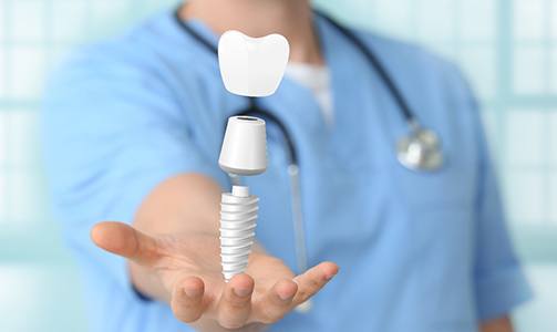 Idaho Falls implant dentist holding out digital rendering of zirconia dental implant